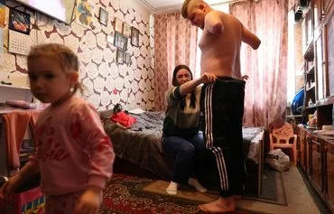 Veronika Kucherenko, 25, the wife of Ukrainian army junior sergeant Valery Kucherenko, 30, helps her husband get dressed at their home in Bila Tserkva, on April 4, amid the Russian invasion in Ukraine. Kucherenko fought the Russian invaders. [Anatolii Stepanov/AFP]